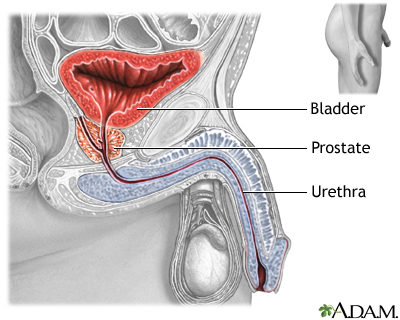 Internal prostate masturbation